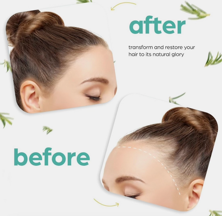 Hair Growth Oil
